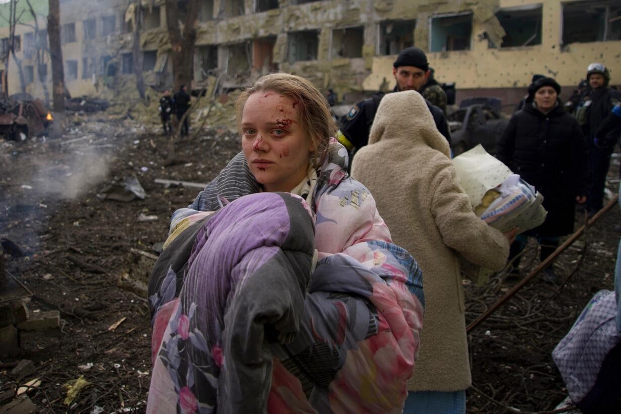 Марианна Подгурская — главная героиня репортажа об обстреле роддома в  Мариуполе — дала первое большое интервью. Разбираем, как этим  свидетельством воспользовалась пропаганда — Meduza