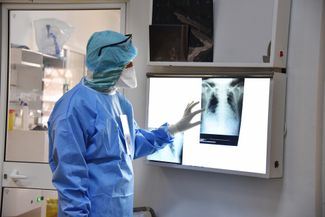 Доктор рассматривает рентгеновский снимок пациента в госпитале тунисского города Арьяна, 12 мая 2020 года