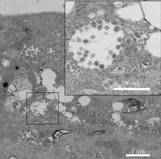Микрофотография вирусных частиц 2019-nCoV