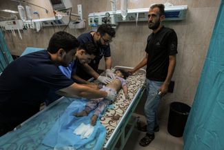 Раненый ребенок в госпитале Аль-Акса города Дейр-эль-Балах, 15 октября 2023 года
