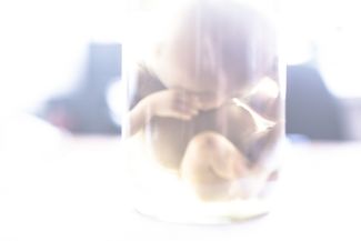 «Гаврюша» — эмбрион в формалине — в гинекологическом отделении Гаврилов-Ямской ЦРБ, 21 апреля 2017 года