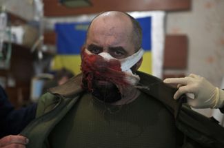 Раненый украинский солдат в медицинском пункте на передовой