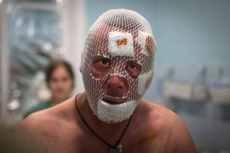 Раненый украинский солдат в медпункте под Бахмутом