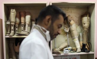 13 декабря 2011 года. Багдад. Предприятие по производству ножных протезов в столице Ирака. Спрос на такие протезы резко вырос из-за боевых действий. Система здравоохранения Ирака после начала операции коалиции оказалась фактически разрушена — многие специалисты-медики покинули страну или погибли.