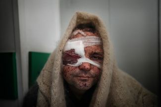Сергей Краля, раненый во время обстрела, в больнице в Мариуполе. 11 марта 2022 года