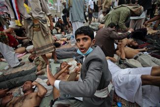 Март 2011 года. Раненые протестующие в Сане, столице и крупнейшем городе Йемена. Уже в первые недели йеменской революции протесты превратились в бои с полицией и войсками. Позже все обернулось полномасштабной гражданской войной, которая, по сути, не закончилась до сих пор