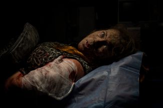 Жительница Херсона, получившая ранение в ходе обстрела города российскими войсками, в машине скорой помощи. 24 ноября 2022 года