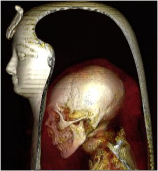 Визуализация головы Аменхотепа I под льняными бинтами и маской по результатам компьютерной томографии 