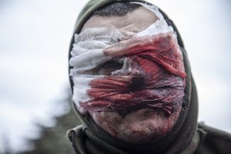 Раненый украинский военнослужащий из Авдеевки. 20 февраля 2024 года