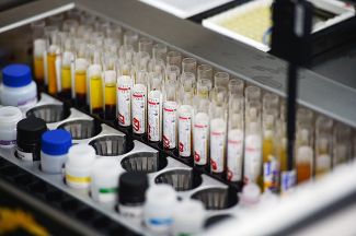 Лаборатория иммуноферментных исследований, где проходит исследование крови на гепатит, сифилис и ВИЧ
