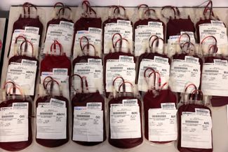 Один из примет военного времени в Украине — массовая добровольная сдача крови для нужд медицинских учреждений