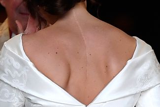 Принцесса Евгения в свадебном платье Peter Pilotto, открывающем шрам на ее спине