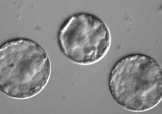 Эмбрионы через несколько дней после введения сперматозоида и редактора Cas9