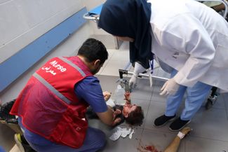Раненый ребенок в больнице Аль-Шифа, крупнейшем госпитале сектора Газа. 11 октября 2023 года