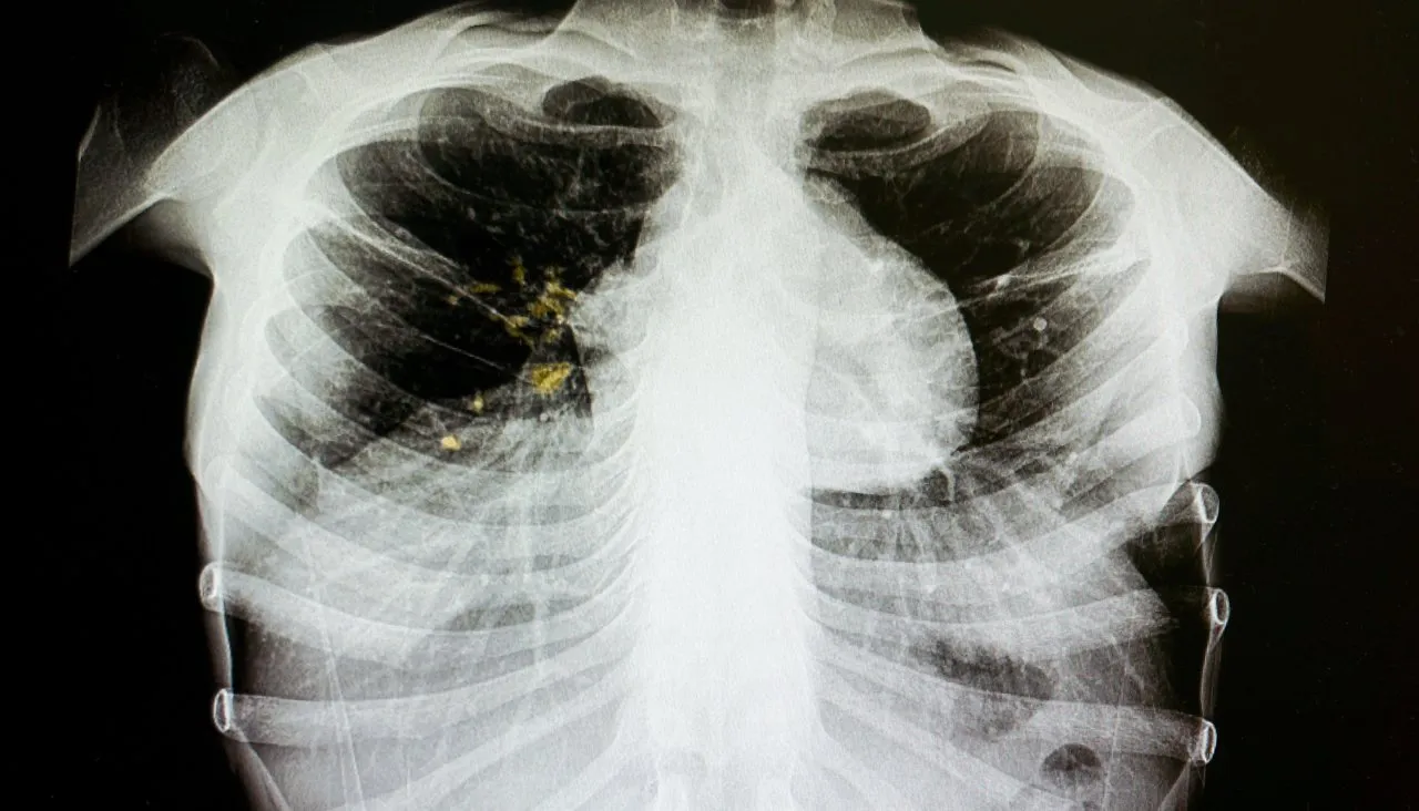 Tomatheart / Shutterstock.com