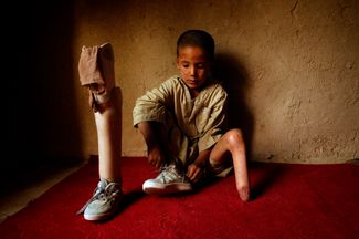Мохаммед Махди, лишившийся ноги при взрыве мины, ждет врача «Красного креста» у себя дома в Кабуле. Август 2004 года. Автор этой фотографии, Эмилио Моренатти, пять лет спустя лишился ступни при дистанционном подрыве бомбы на обочине в Кандагаре.