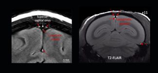 Слева — МРТ-изображение мозга человека, справа — обезьяны. Лимфатические сосуды обозначены красными стрелками