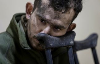 Раненый пленный военнослужащий ВСУ в больнице самопровозглашенной ДНР.